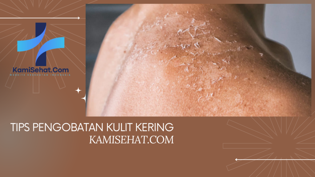 Tips Pengobatan Kulit Kering Secara Alami dan Medis Agar Kulit Tetap Sehat
