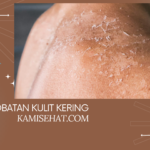 Tips Pengobatan Kulit Kering Secara Alami dan Medis Agar Kulit Tetap Sehat